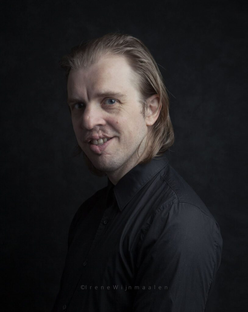 JanJaap van der Wal, comédien, portrait d'un homme avec une fente labio-palatine ou bec de lièvre